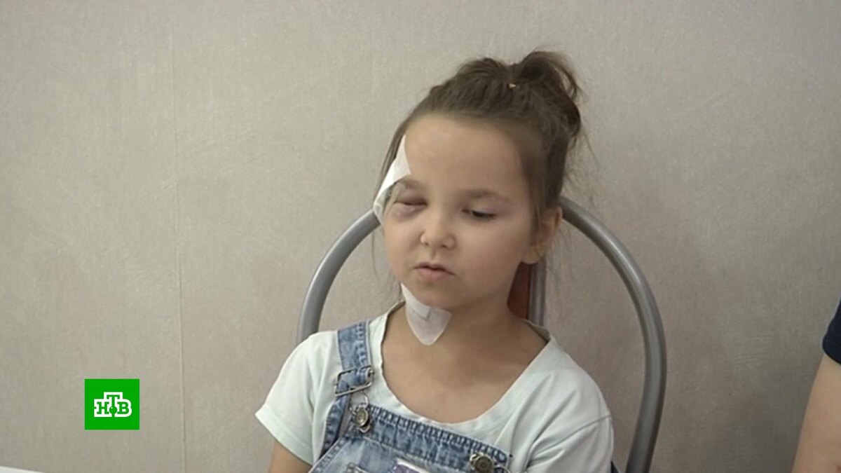    «Побежал на меня»: семилетняя девочка рассказала о нападении собаки в подъезде