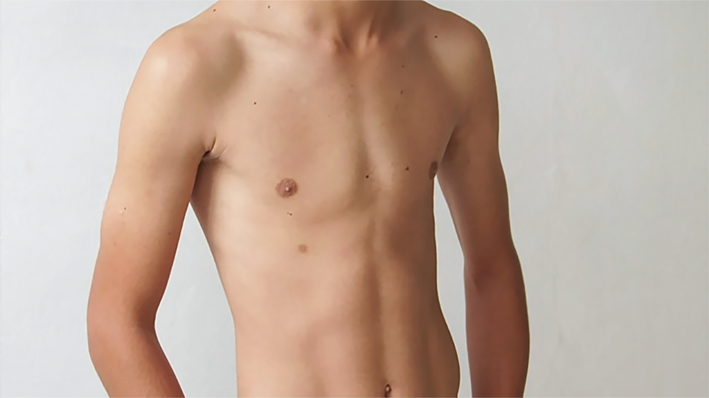 То самое тело «скинни фэт». Вроде вес нормальный, но...