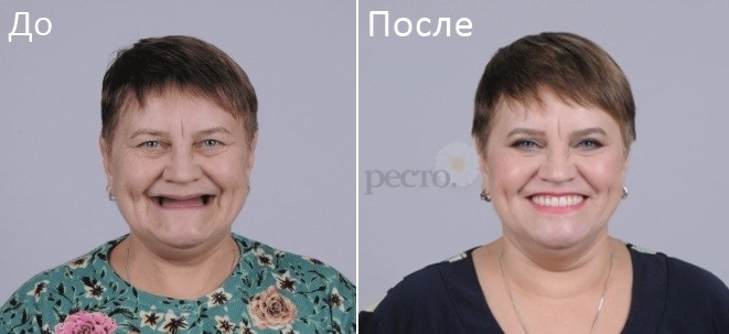 Стоматологическая клиника РЕСТО Ижевск