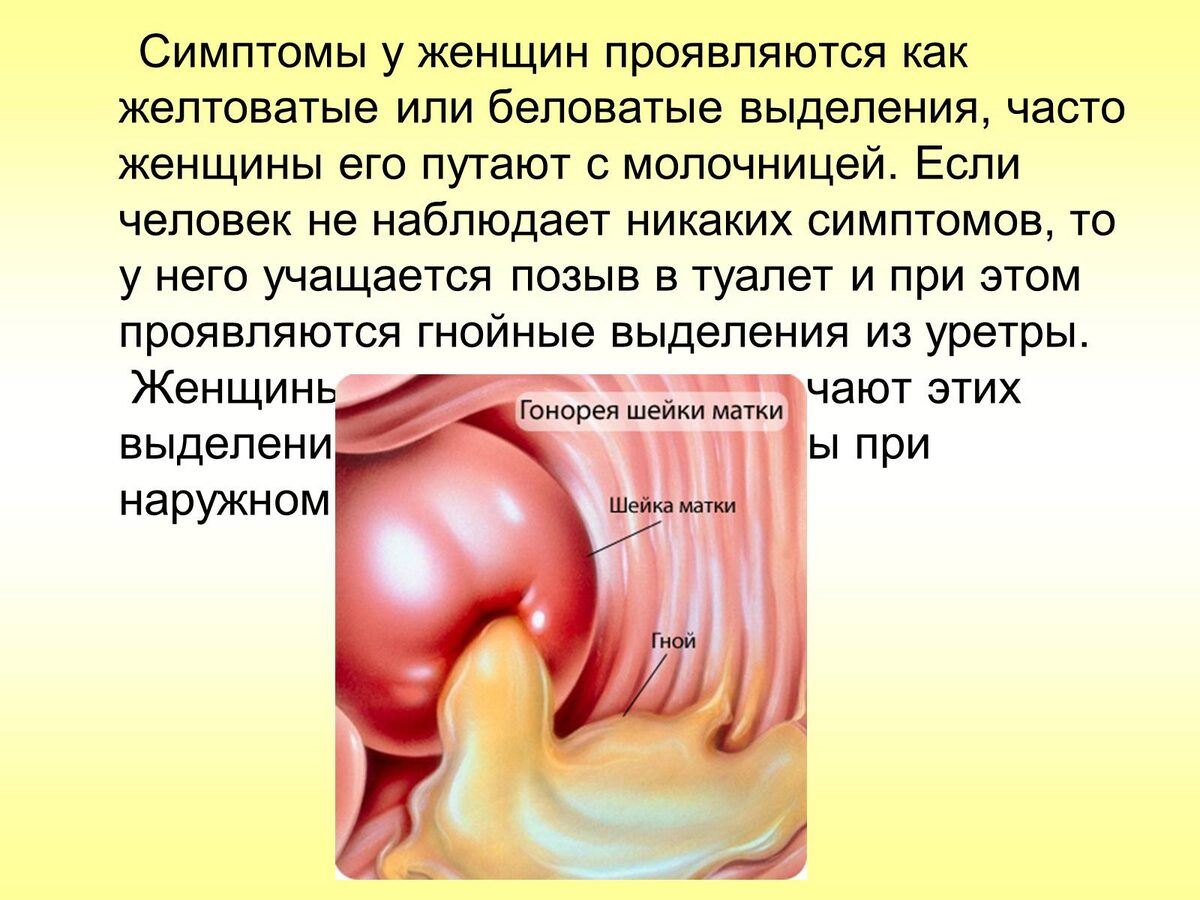 фото из Инета