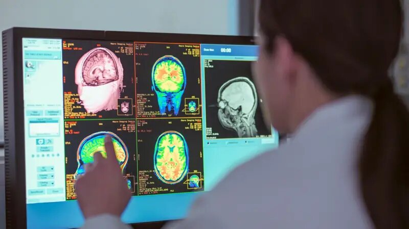 Фото: MONTY RAKUSEN/GETTY