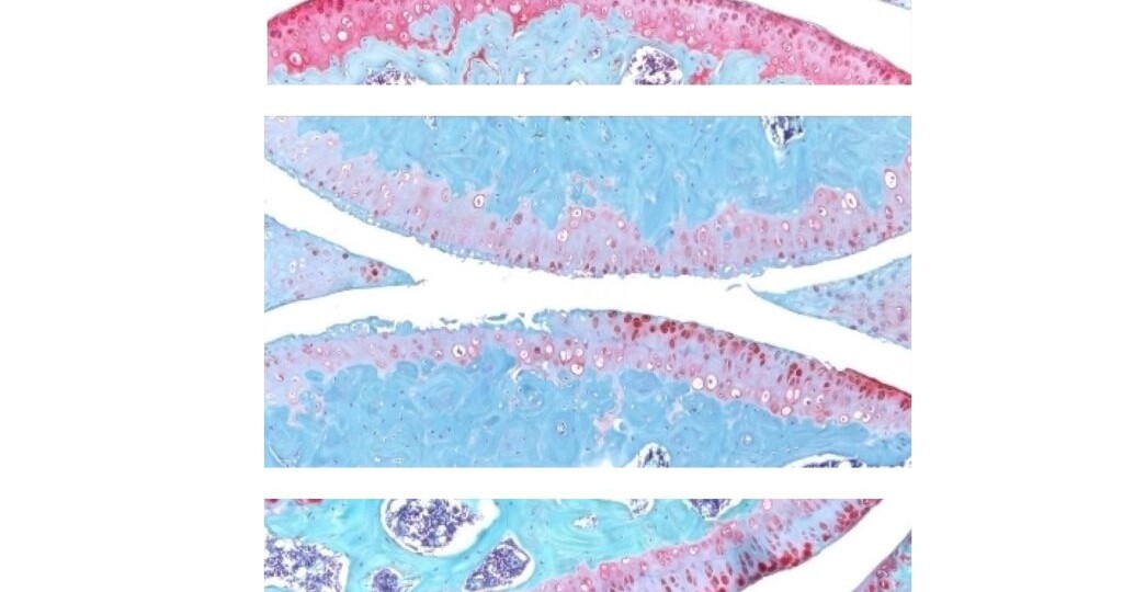 Выключатель старения: регенерация вместо протеза.