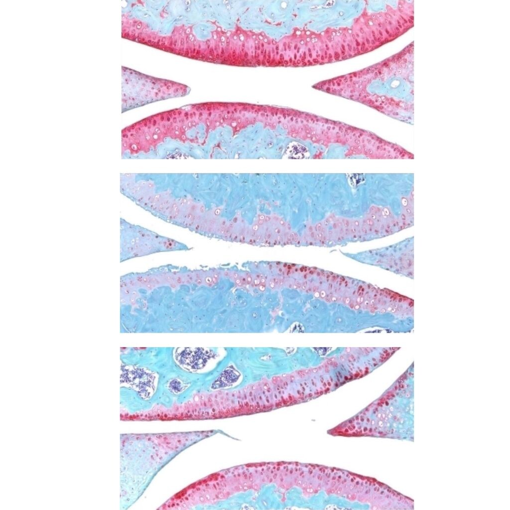 Коленный сустав молодой мыши (вверху), старой мыши (в центре) и старой мыши, прошедшей лечение (внизу). Красным обозначен хрящ. Источник - https://med.stanford.edu/
