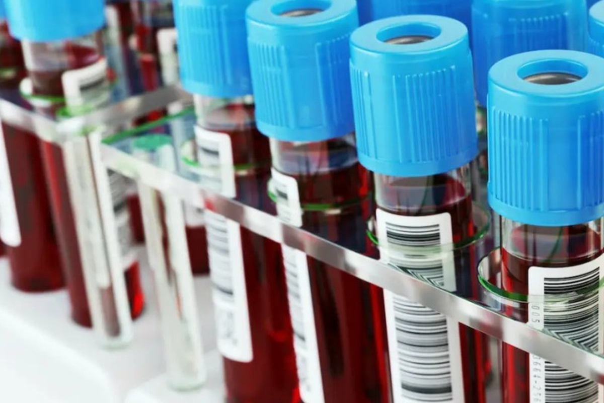    Фото: cereb.su; источник:ООО «Церебрум-М»