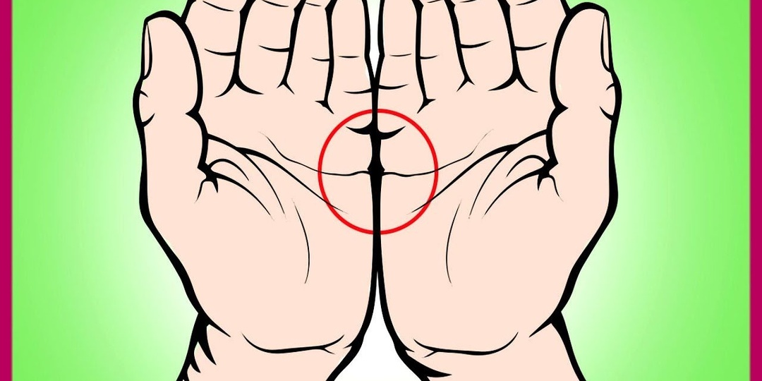 Что расскажут о здоровье линии на руках — неожиданные выводы врачей