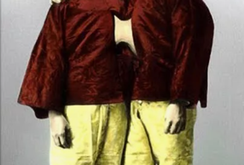 Как сиамские близнецы смогли наплодить столько детей: были ли среди них такие же