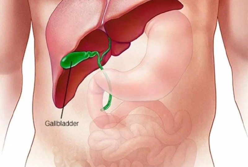 🟡 УЗИ и застой желчи: что видно, а что чувствует человек