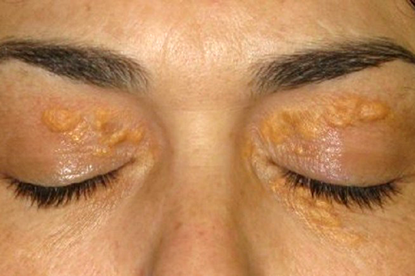 9 признаков, которые предскажут скорые проблемы со здоровьем