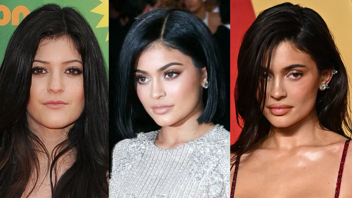 Посмотрите, как меняется образ Кайли Дженнер: поклонники активно обсуждают ее более спокойные губы и мягкие контуры. На фото до и после легко уловить результаты яркой пластики и возвращение к естественной красоте.