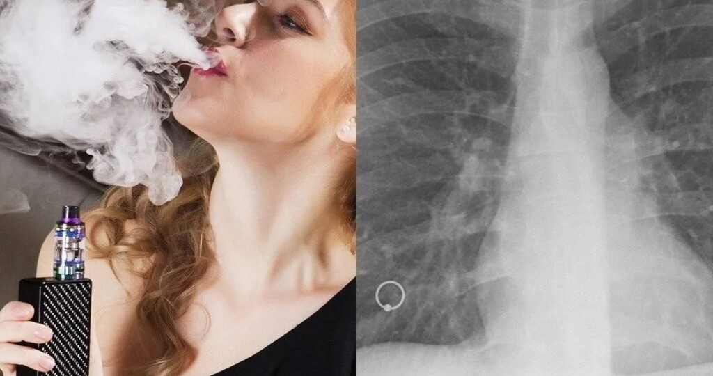 «Я делала 4000 затяжек в неделю»: как вейп чуть не убил 17-летнюю студентку