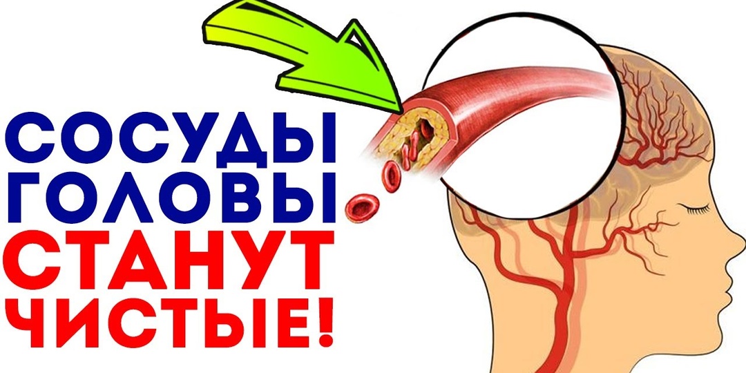 8 Симптомов, Что СОСУДЫ Мозга Теряют Эластичность (чек-лист)