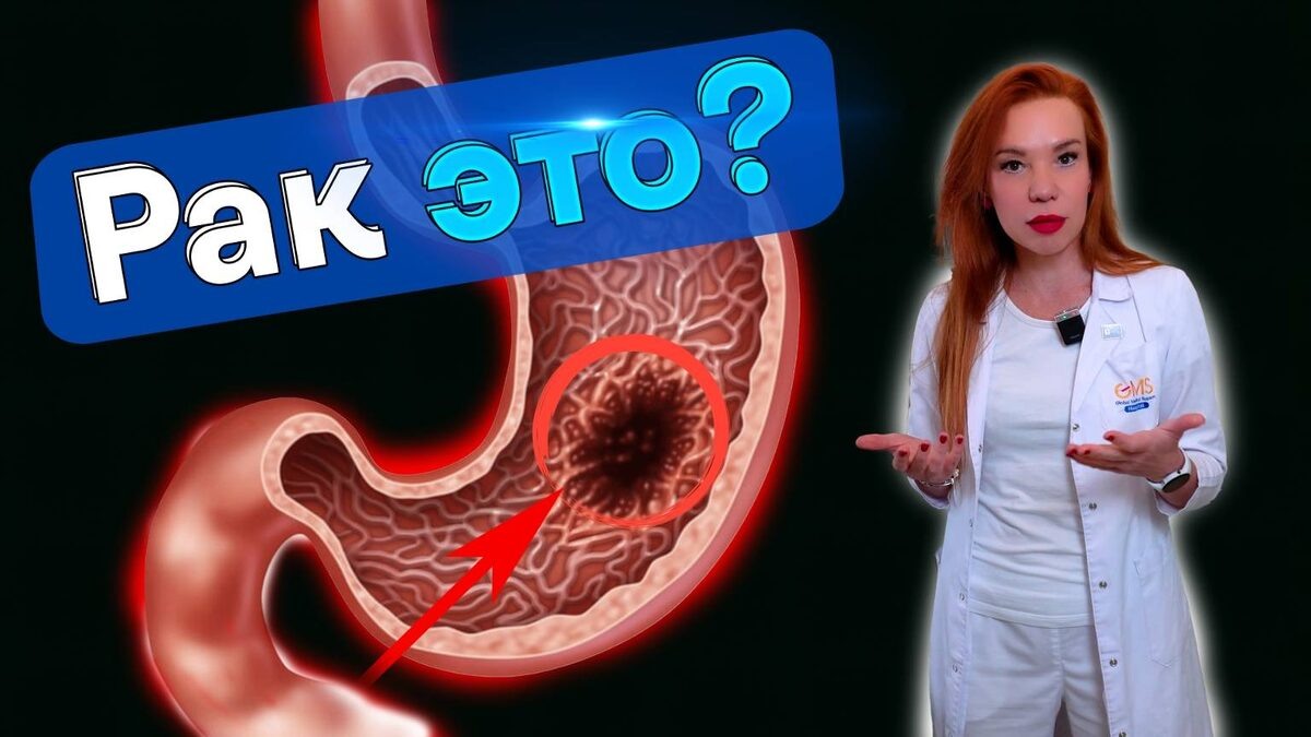 Онколог Объяснил, Какие Изменения В ЖЕЛУДКЕ Опасны После 50 (интервью)