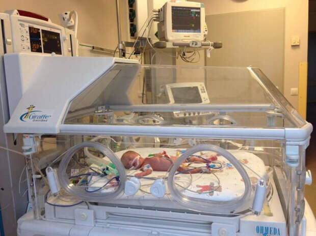 Младенец в медикоре (из интернета)