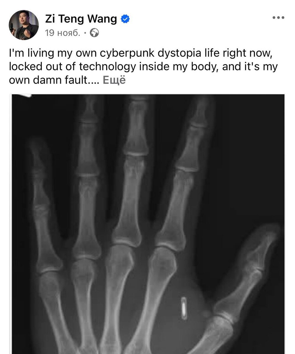 Пост Зи Тэн Ванга в Facebook о том, что вживленный чип окочурился. Источник: Facebook