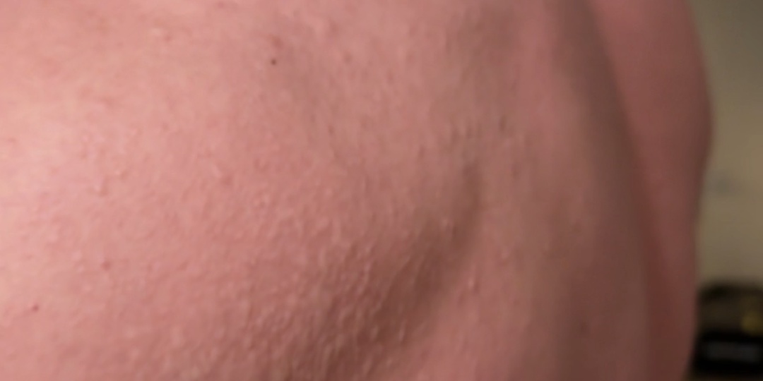 Печень как диагност: 5 клинически значимых сигналов до изменений в анализах