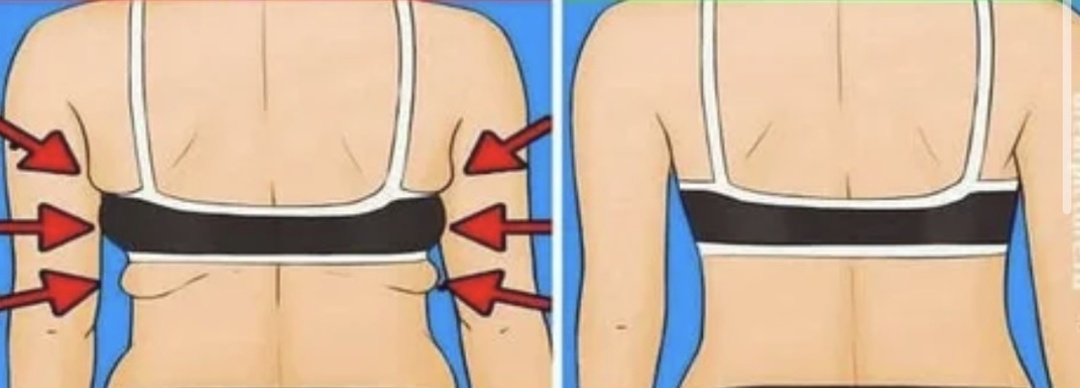 Долой складки на спине: 3 несложных упражнения