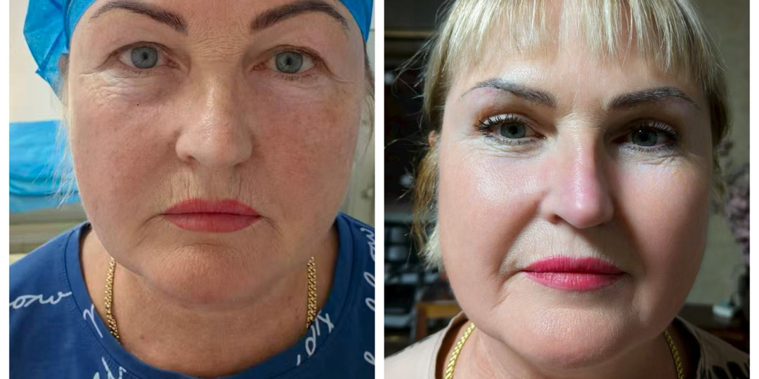 Санаторий «Син Хуа» в г. Удалянчи. Руководство к пользованию.