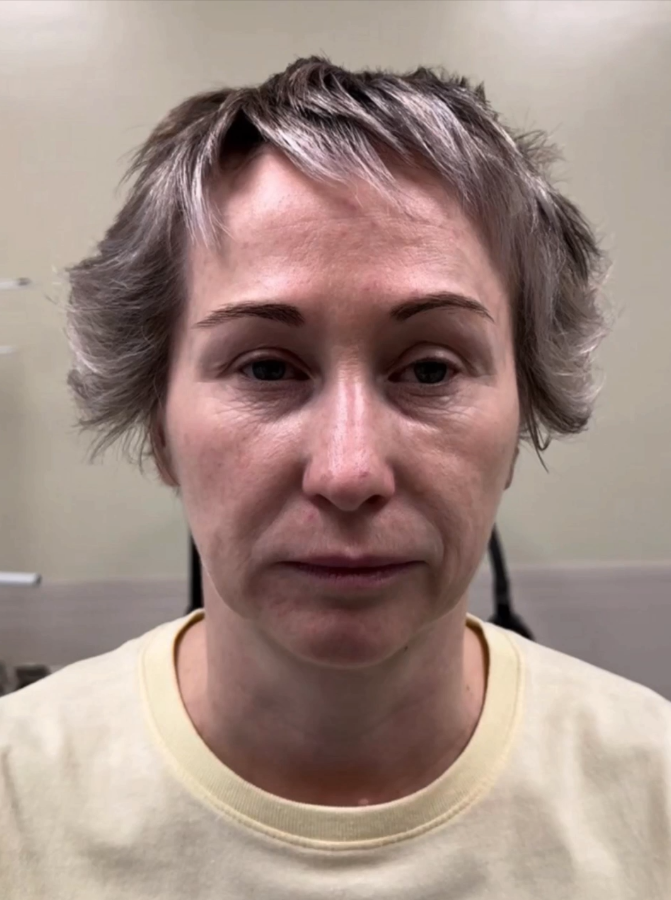 До выполнения первого этапа омоложения