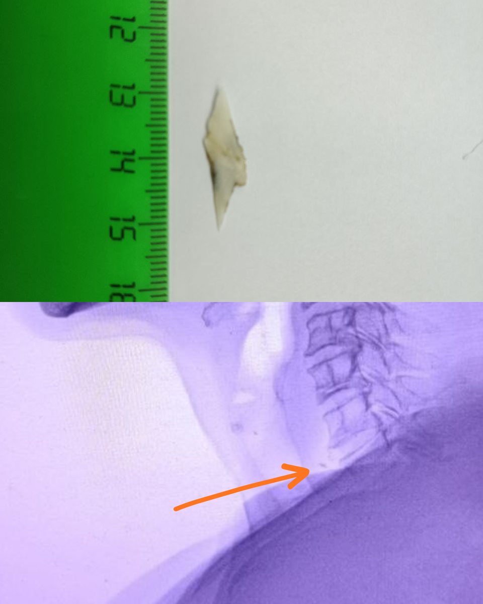 Ответ на загадку (листайте карусель)