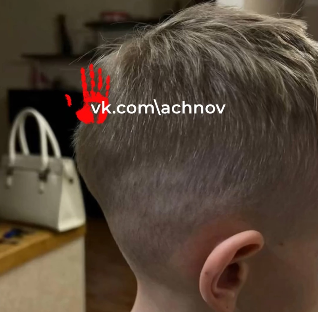 Пострадавший ребенок