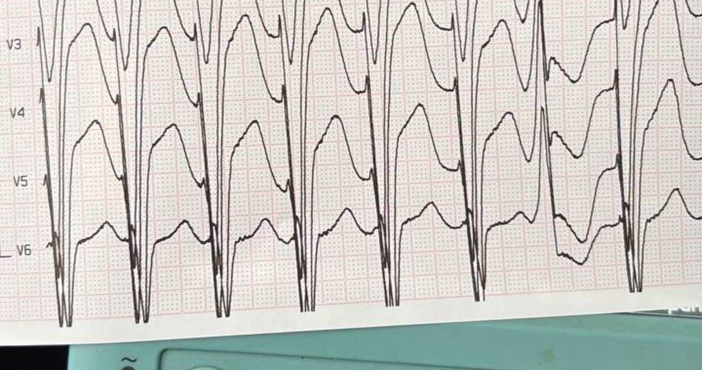 -Встал… и будто провалился!