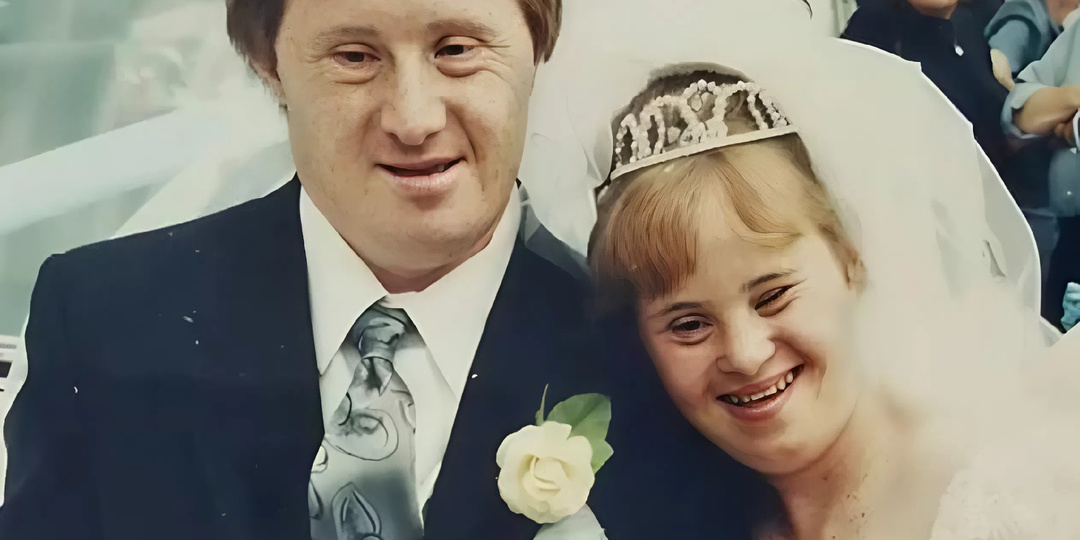 Первая пара с синдромом Дауна поженилась в 1995 г: что с ними стало спустя 30 лет