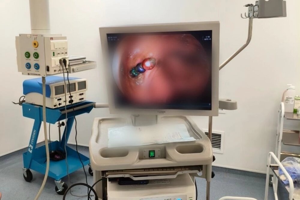    В кишечнике магниты соединяются друг с другом, что может спровоцировать непроходимость. Фото: ДРКБ РБ