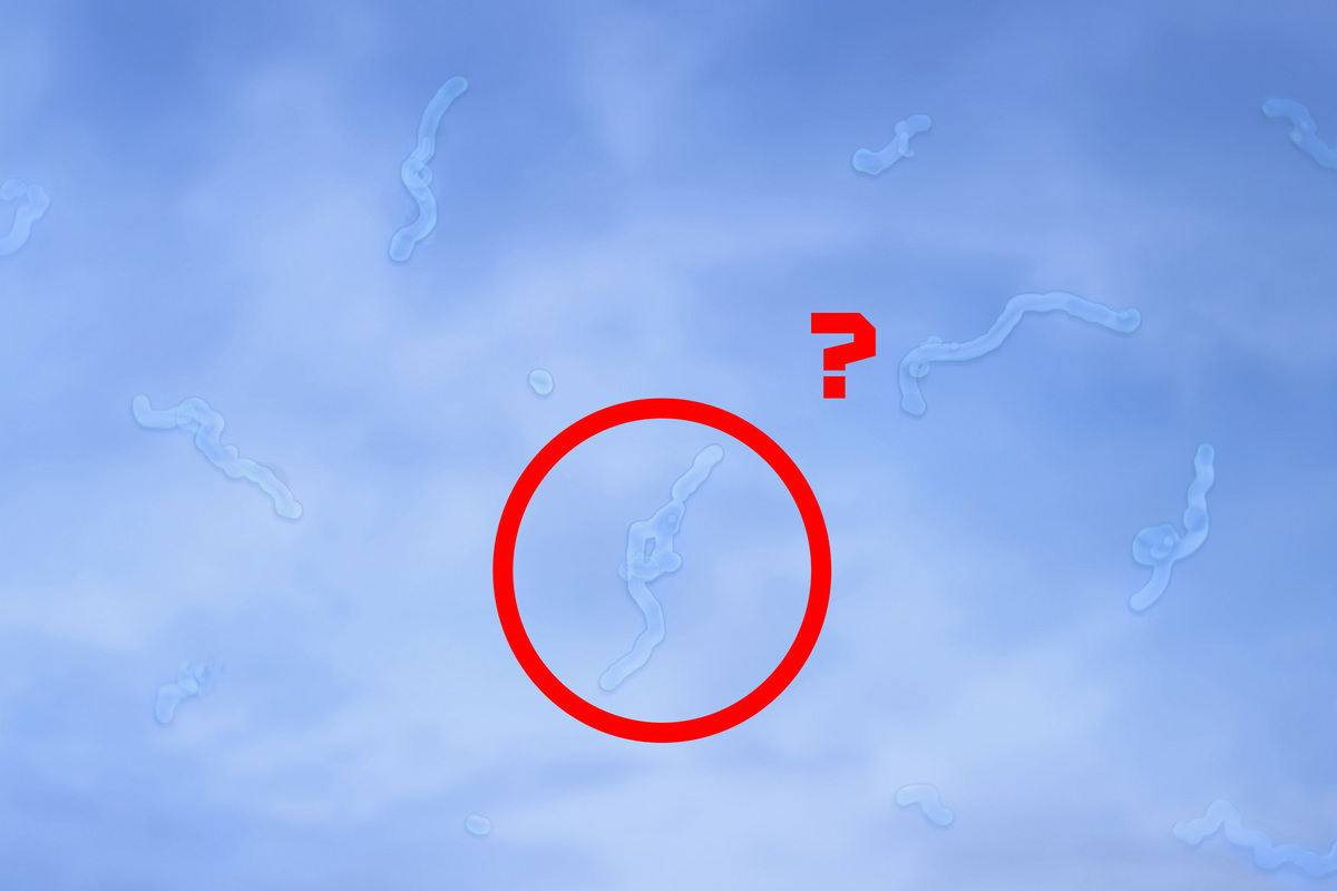     Почему время от времени перед глазами появляются темные или полупрозрачные «мушки»?