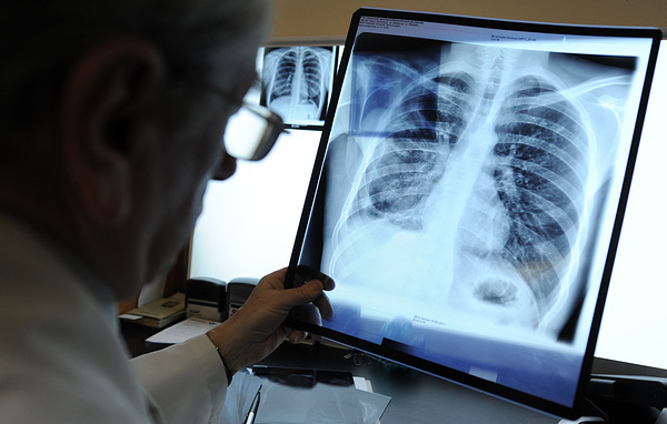 Руслан Шамуков/ ТАСC