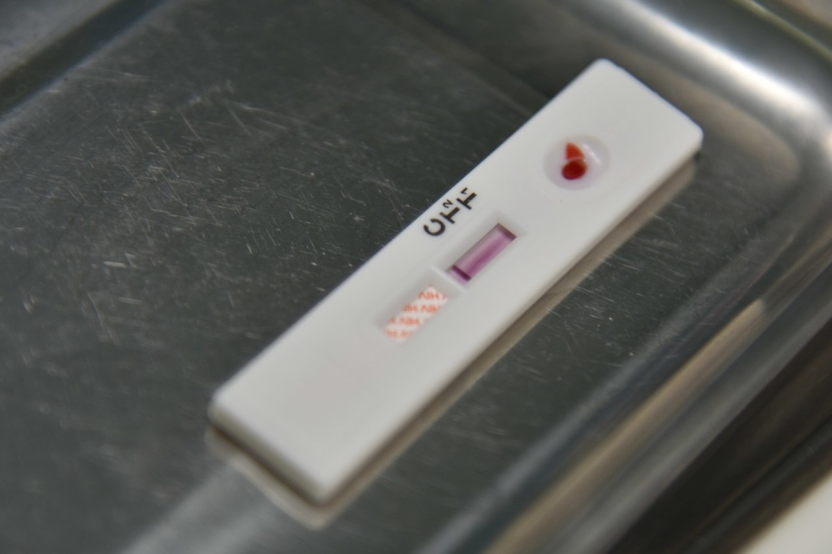    Экспресс-тест на ВИЧ. Фото: "Республика" / Николай Смирнов.