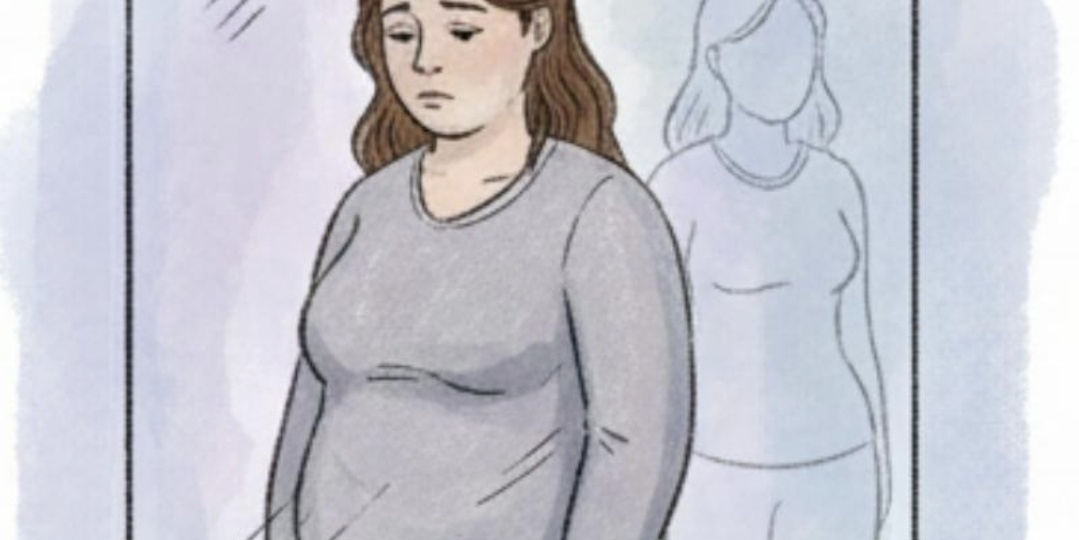 Пластическая хирургия после бариатрии