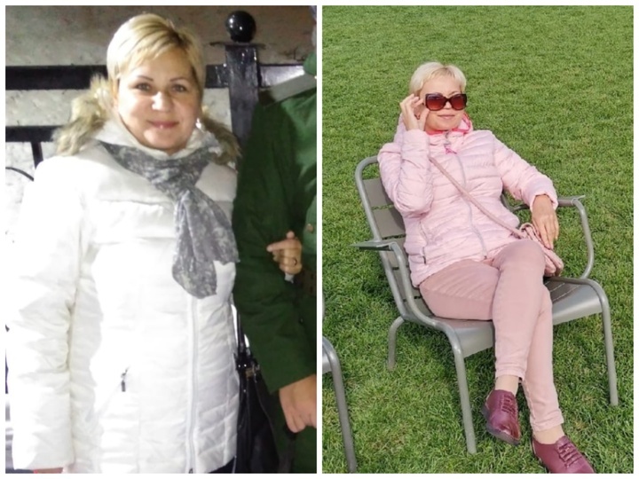 До и после похудения. 