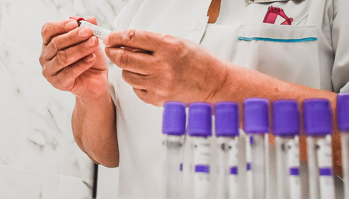 Не все зараженные ВИЧ находятся на учете у медиков. Фото: Антон Засимов, 1MI