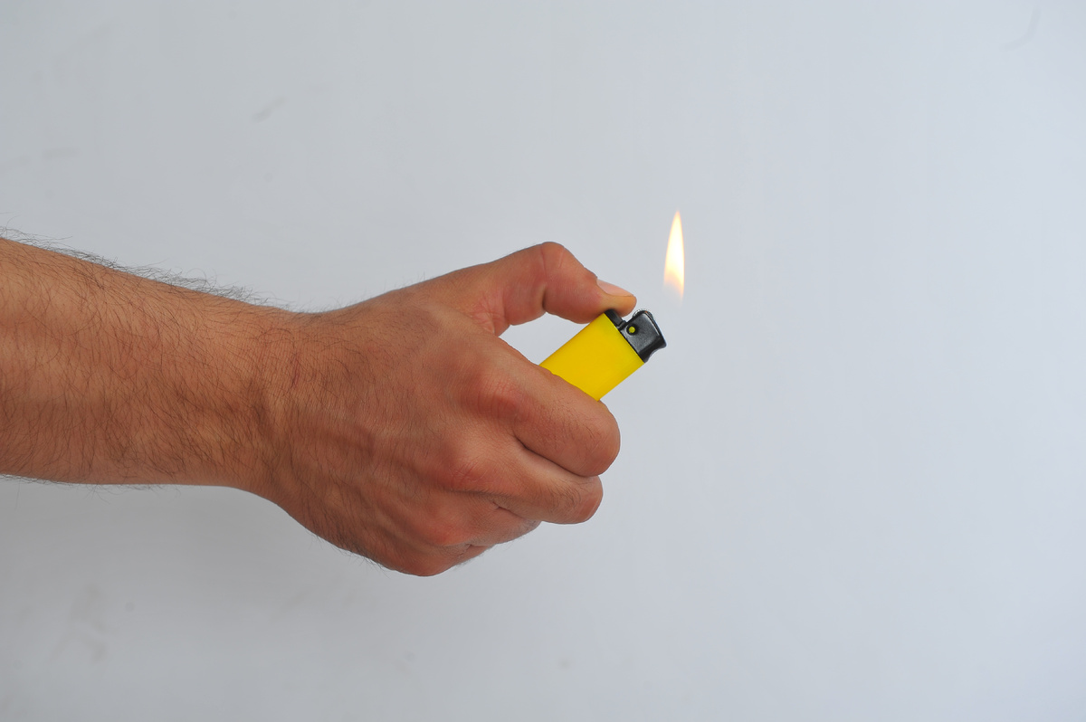 Зажигалка пролежала в животе китайца более 30 лет! Фото: Евгения Гусева