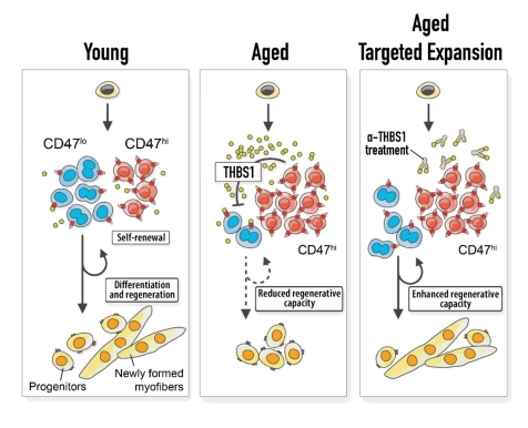 Источник изображения - med.stanford.edu