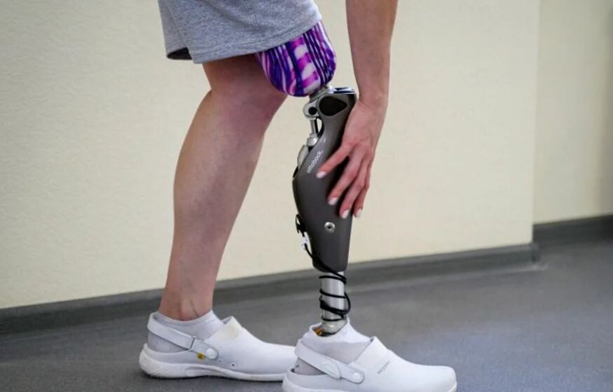    Поддержка ветеранов СВО: инновации протезирования в центре Тулы