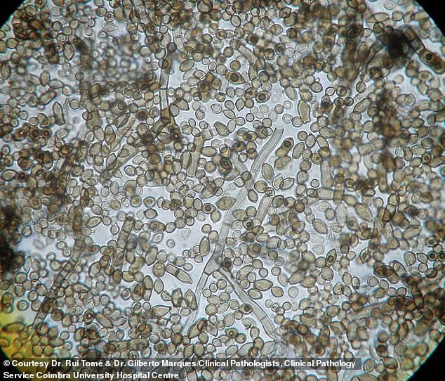 C. sphaerospermum под микроскопом. Было обнаружено, что этот гриб превращает опасные гамма-лучи в энергию.