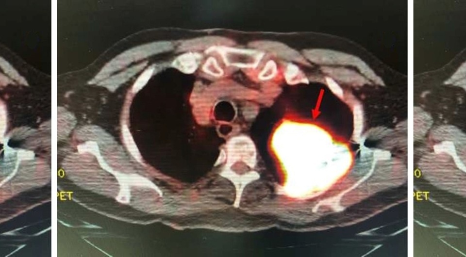   Alexandra Bartholomew et al. / BMJ Case Reports, 2025