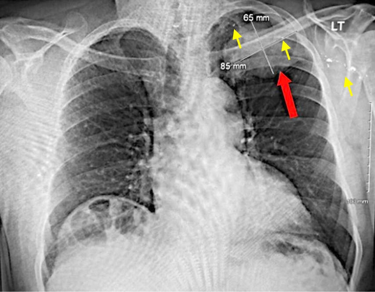   Alexandra Bartholomew et al. / BMJ Case Reports, 2025