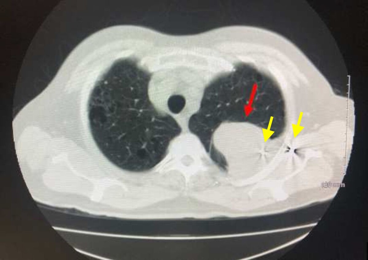   Alexandra Bartholomew et al. / BMJ Case Reports, 2025