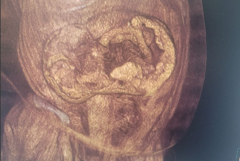     Фото: Минздрав ВО