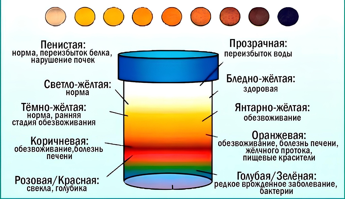 О чем говорит цвет мочи?