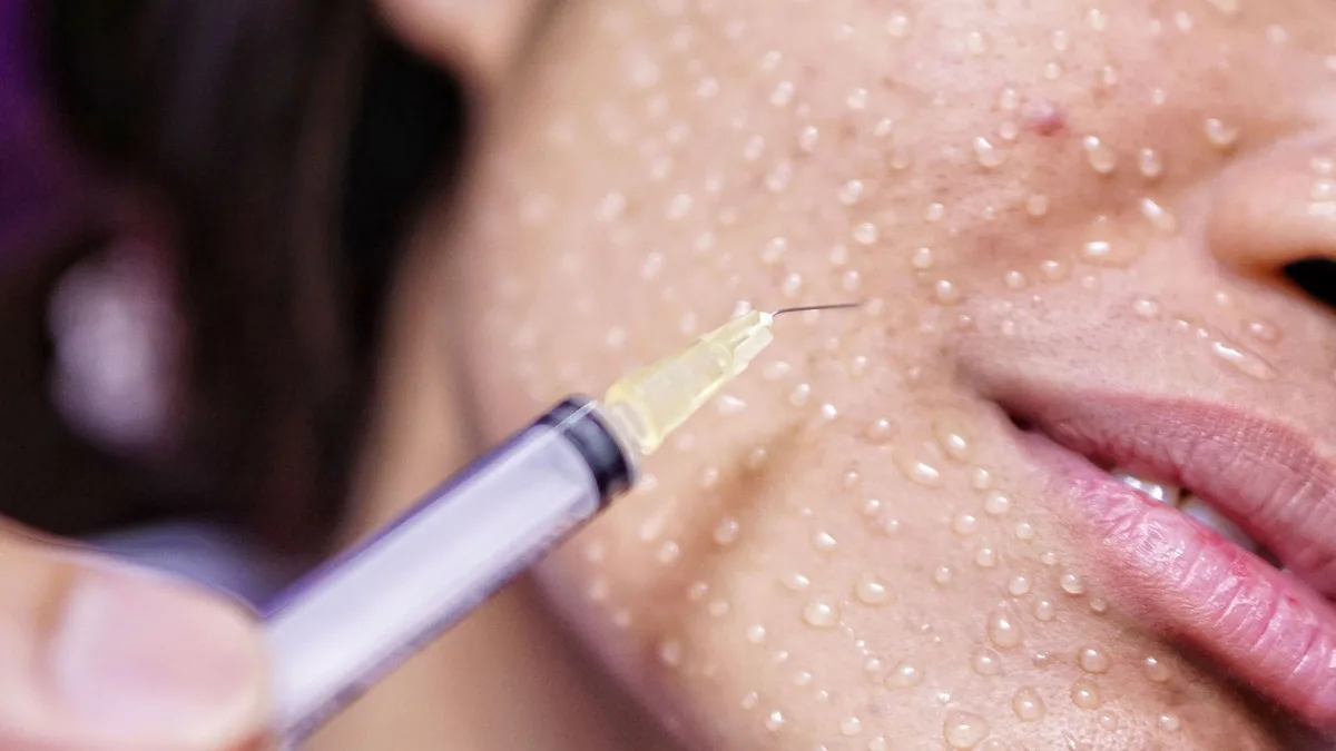 Папульная техника — введение препарата микродозами в виде небольших точек под кожей