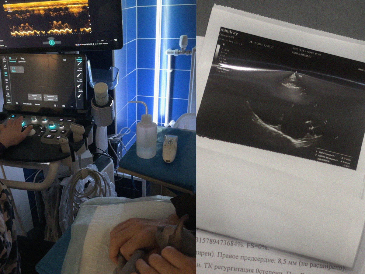 УЗИ сердца - обязательная процедура для сфинксов раз в 1-2 года. Основная группа риска - сфинксы в возрасте от 1 до 5 лет