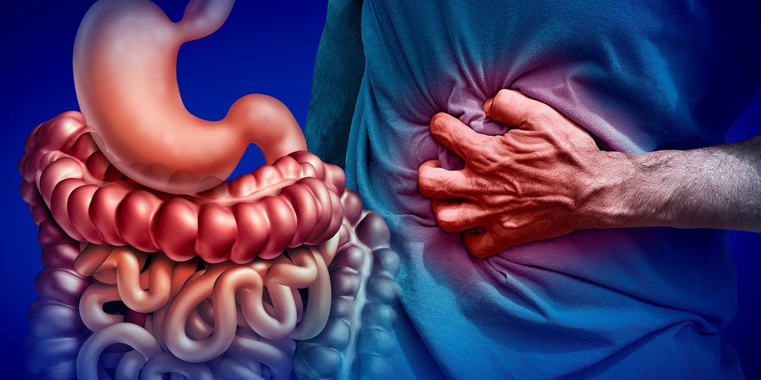 Гастроэнтеролог Рассказал, Какие Симптомы КИШЕЧНИКА Чаще Всего Оказываются Предраковыми (интервью)