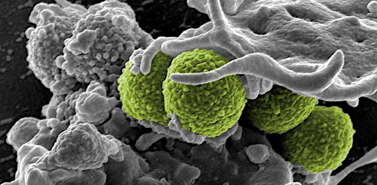Золотистый стафилококк, устойчивый к антибиотикам бета-лактамам (MRSA)