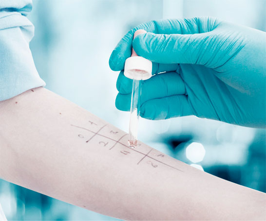 Аллерген-специфическая иммунотерапия (АСИТ)