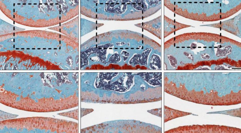   Singla et al. / Science, 2025