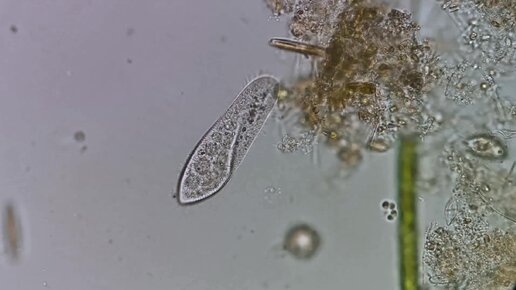 В одной капле воды может кипеть жизнь, более бурная, чем в мегаполисе.