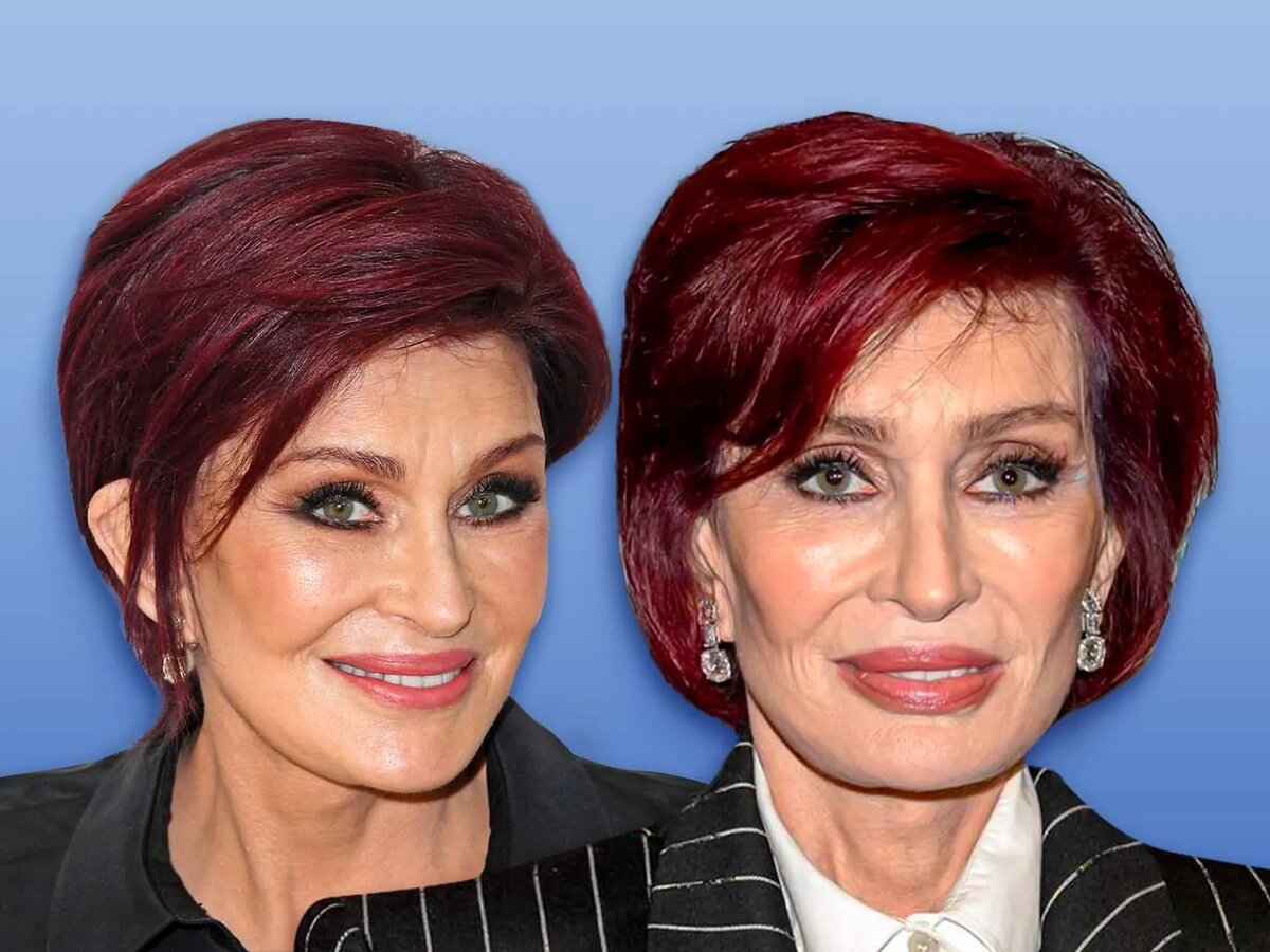 Жена Оззи Осборна, Шэрон Осборн регулярно использует инъекции препарата